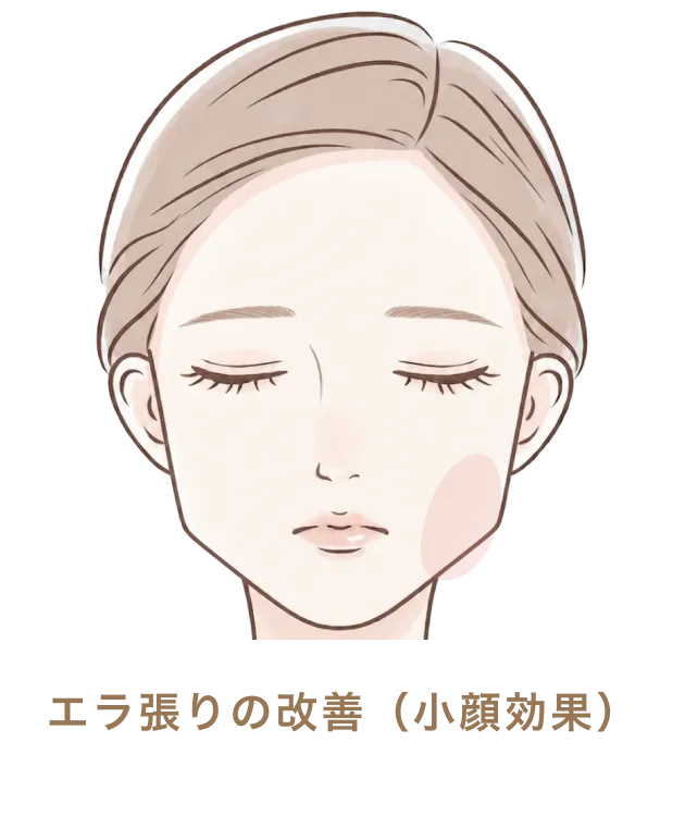 エラ張りの改善（小顔効果）