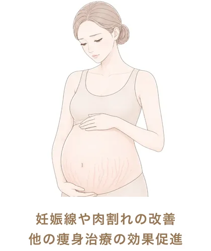 妊娠線や肉割れの改善他の痩身治療の効果促進