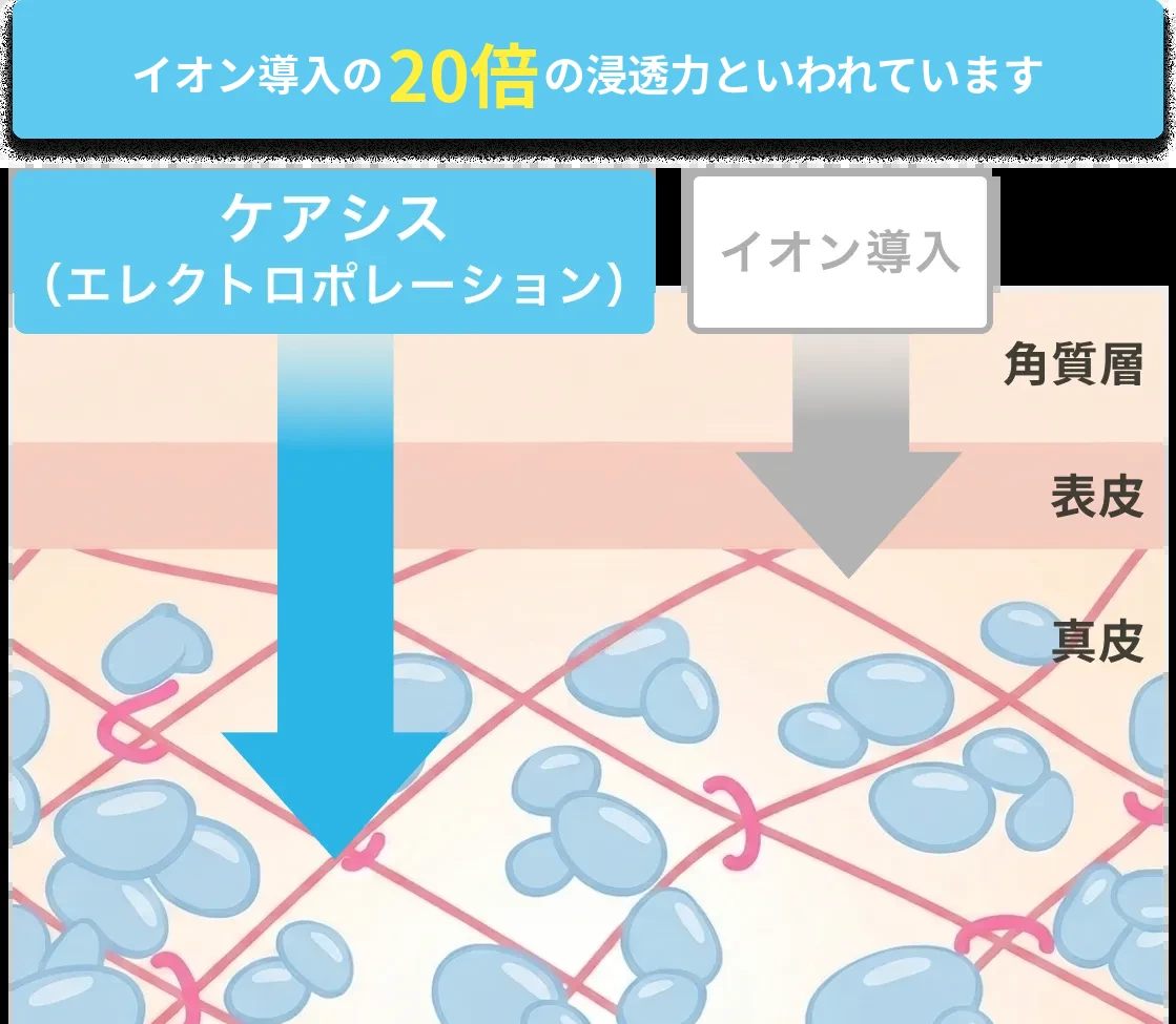 ケアシス（エレクトロポレーション）とイオン導入の浸透深度の比較図