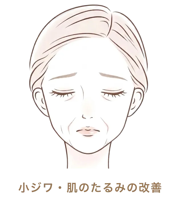 小ジワ・肌のたるみの改善