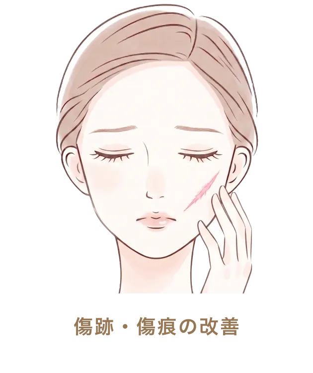 傷跡・傷痕の改善
