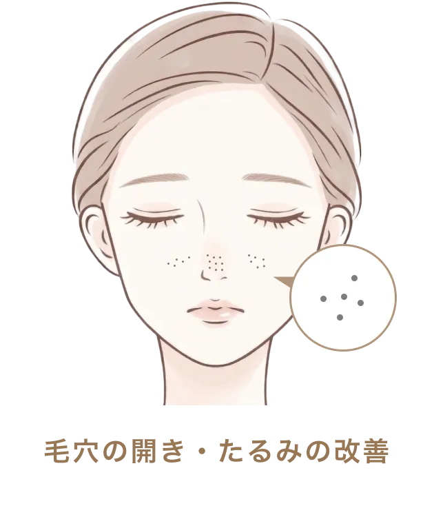 毛穴の開き・たるみの改善