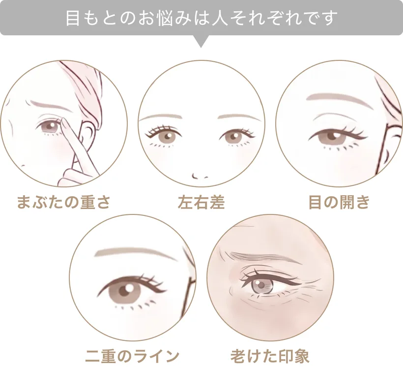 目もとのお悩みは人それぞれです。まぶたの重さ／左右差／目の開き／二重のライン／老けた印象