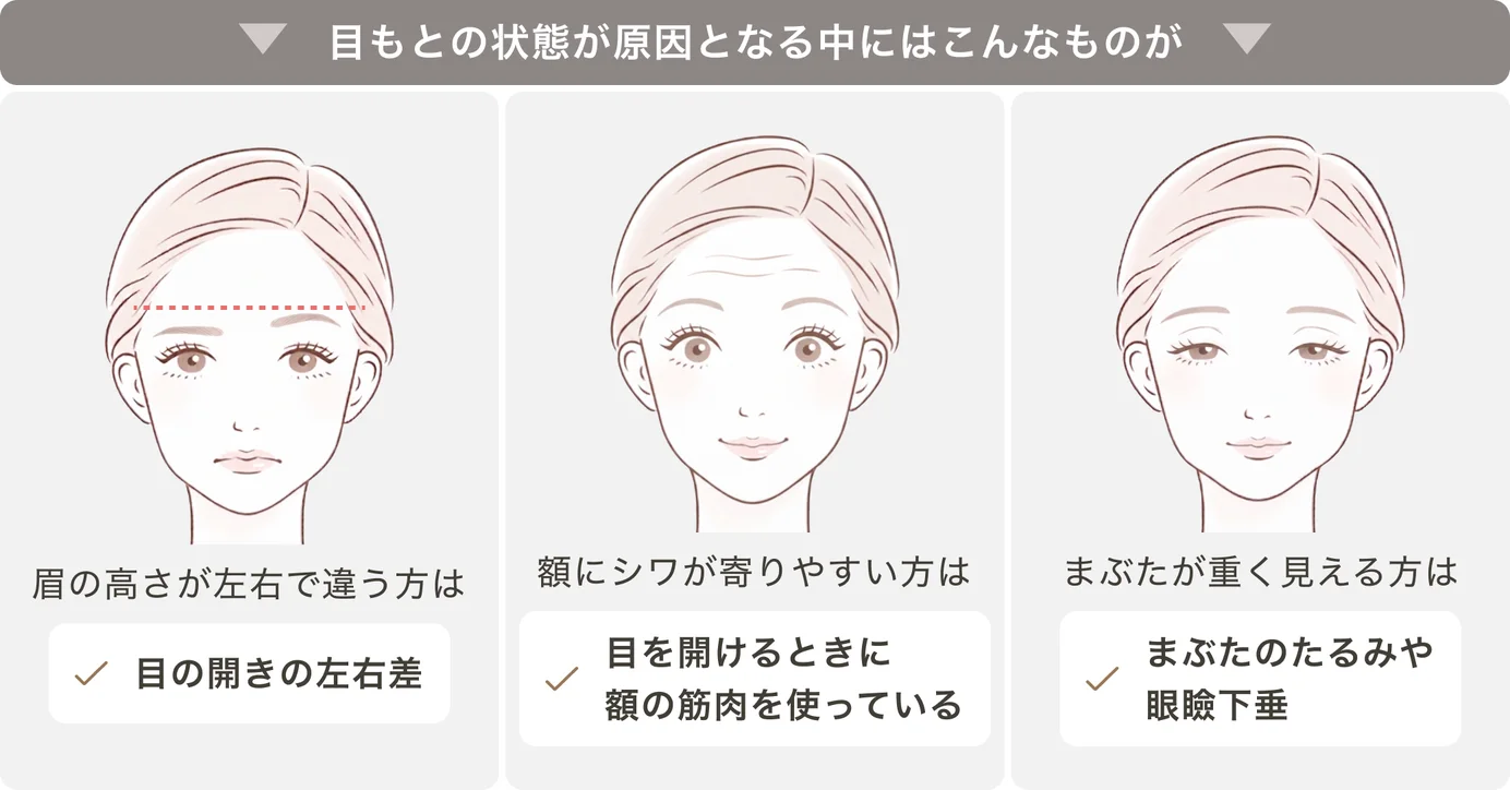 目もとの状態が原因となる中にはこんなものが。眉の高さが左右で違う方は目の開きの左右差／額にシワが寄りやすい方は目を開けるときに額の筋肉を使っている／まぶたが重く見える方はまぶたのたるみや眼瞼下垂