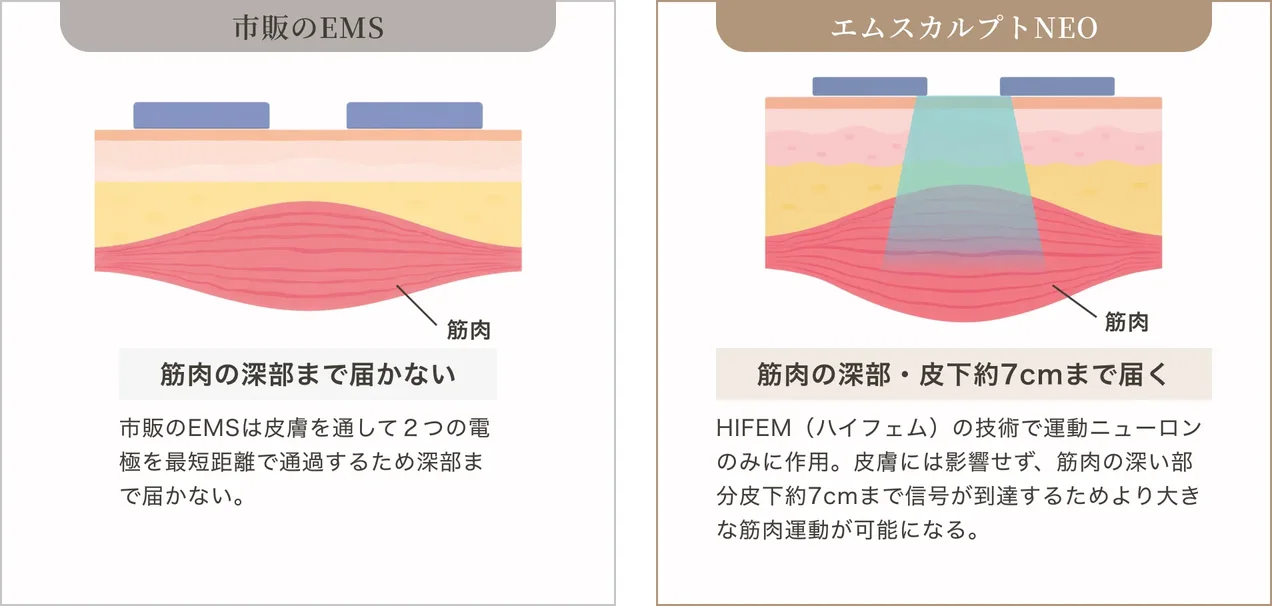 市販のEMSは2つの電極間を最短距離で通るため筋肉の深部まで届かないのに対し、エムスカルプトNEOはHIFEMにより皮下約7cmまで届くことを示した皮膚断面の比較図
