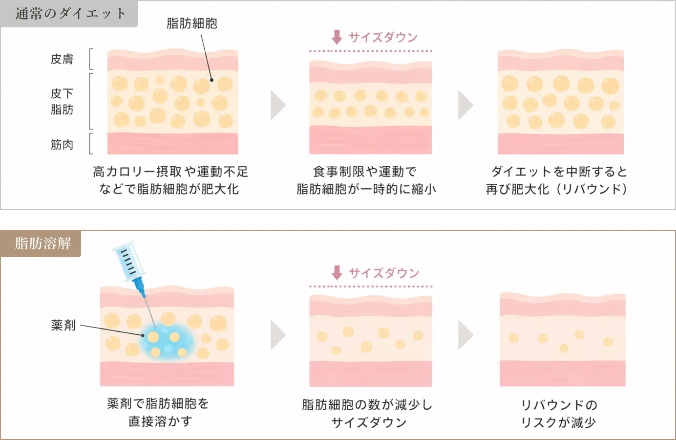 通常のダイエットでは脂肪細胞が一時的に縮小するだけで中断すると再び肥大化するのに対し、脂肪溶解注射では薬剤で脂肪細胞そのものを溶かし数を減らすためリバウンドのリスクが減ることを示した図