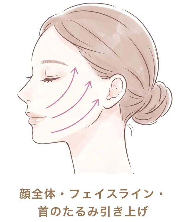 顔全体・フェイスライン・首のたるみ引き上げ