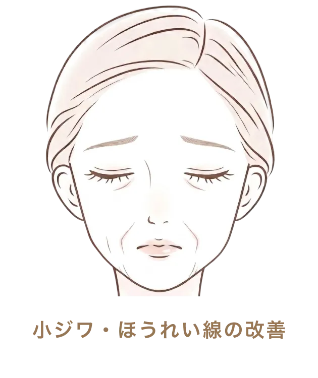 小ジワ・ほうれい線の改善
