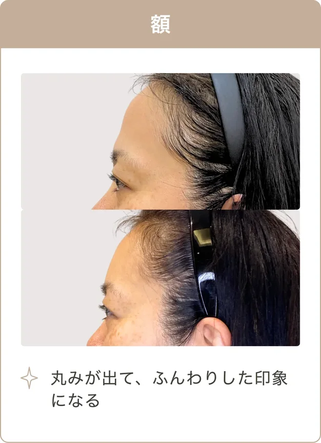 額：丸みが出て、ふんわりした印象になる