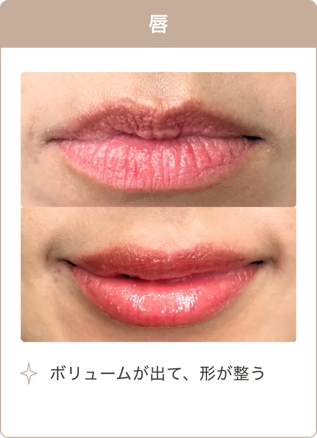 唇：ボリュームが出て、形が整う