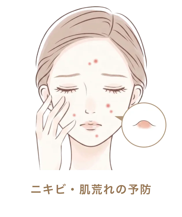 ニキビ・肌荒れの予防