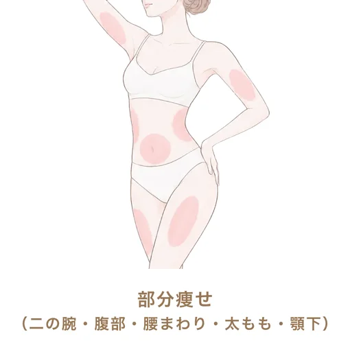 部分痩せ（二の腕・腹部・腰まわり・太もも・顎下）