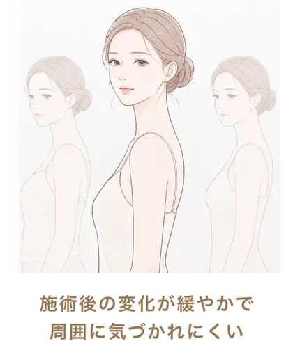 施術後の変化が緩やかで周囲に気づかれにくい