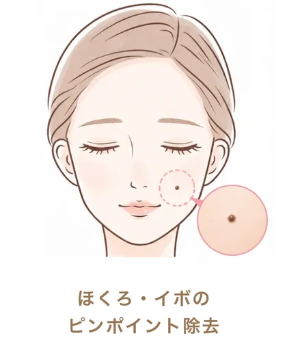 ほくろ・イボのピンポイント除去
