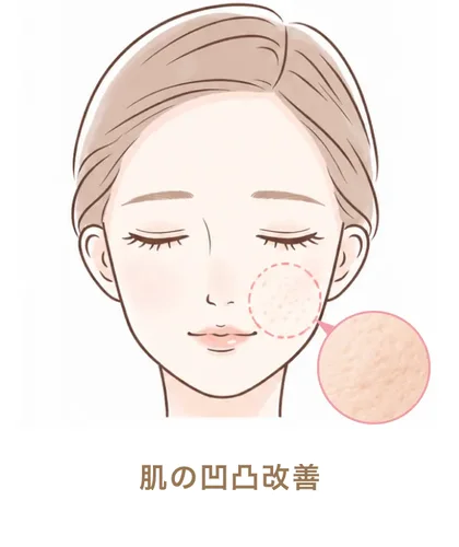 肌の凹凸改善