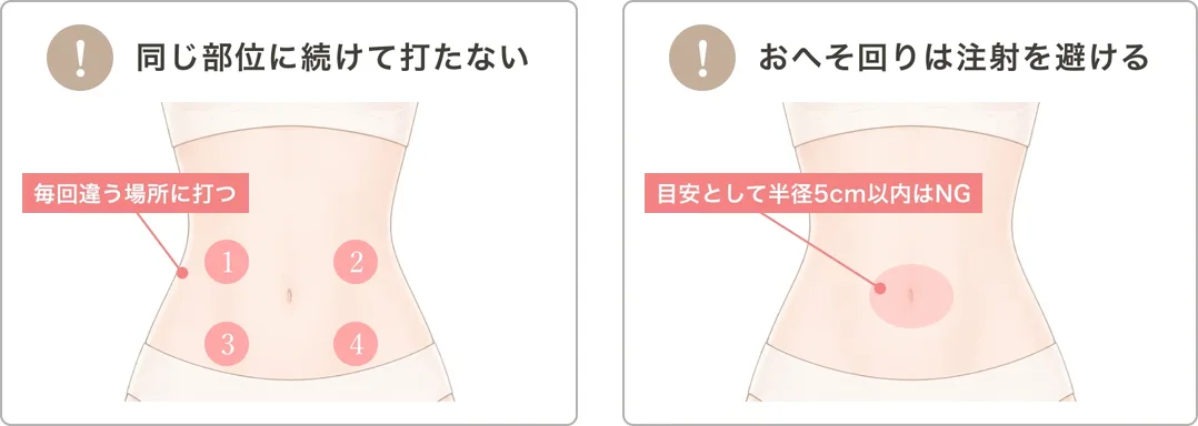 同じ部位に続けて打たない（毎回違う場所に打つ）／おへそ回りは注射を避ける（目安として半径5cm以内はNG）