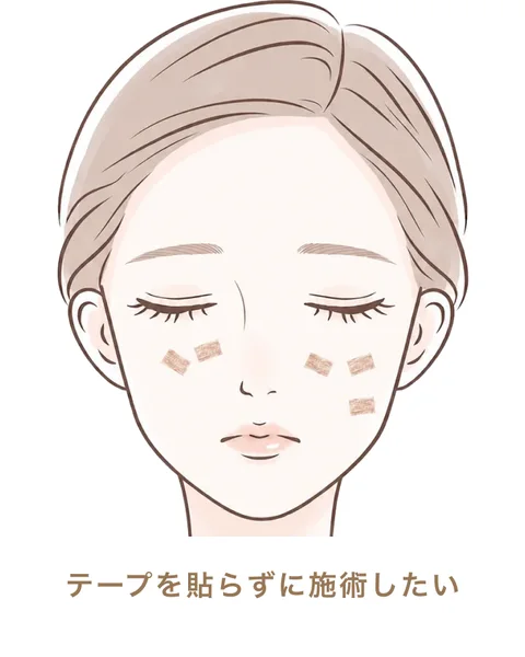 テープを貼らずに施術したい