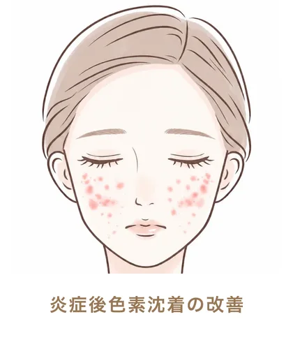 炎症後色素沈着の改善