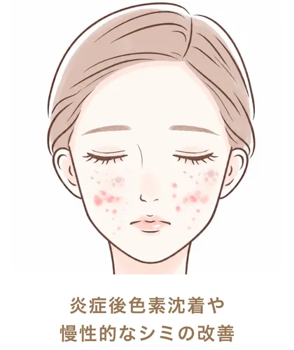 炎症後色素沈着や慢性的なシミの改善