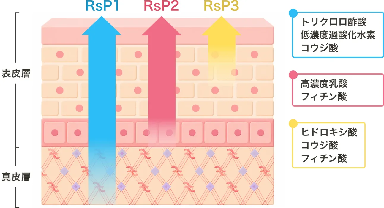 RsP1（トリクロロ酢酸・低濃度過酸化水素・コウジ酸）が真皮層まで、RsP2（高濃度乳酸・フィチン酸）が表皮中層まで、RsP3（ヒドロキシ酸・コウジ酸・フィチン酸）が表皮浅層までそれぞれ届くことを示す断面図