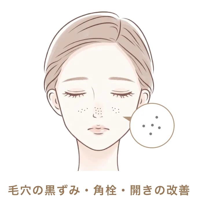毛穴の黒ずみ・角栓・開きの改善