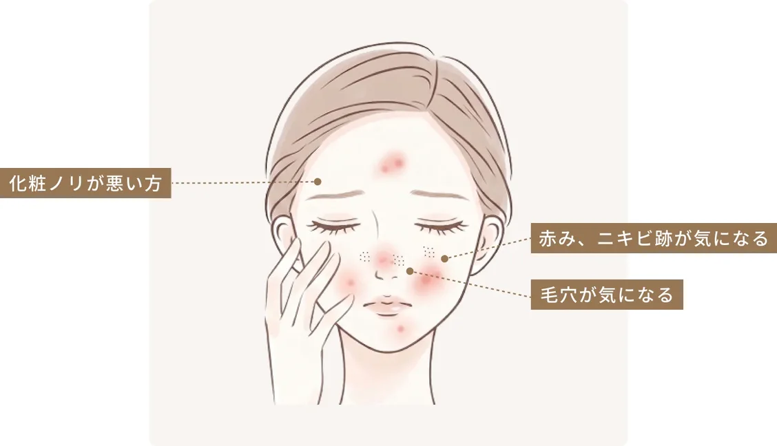化粧ノリが悪い方／赤み、ニキビ跡が気になる／毛穴が気になる