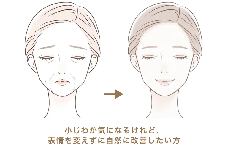 小じわが気になるけれど、表情を変えずに自然に改善したい方