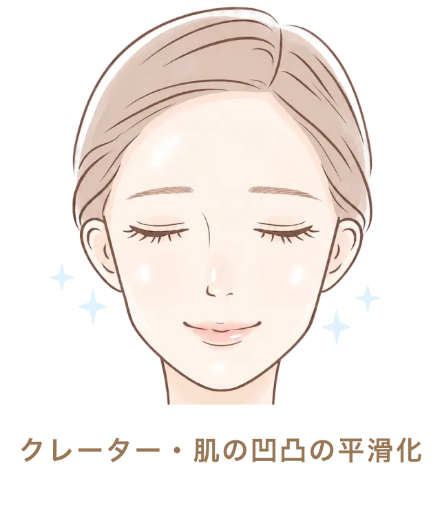 クレーター・肌の凹凸の平滑化