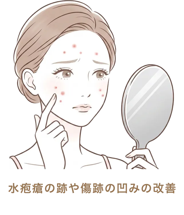 水疱瘡の跡や傷跡の凹みの改善