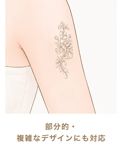 部分的・複雑なデザインにも対応