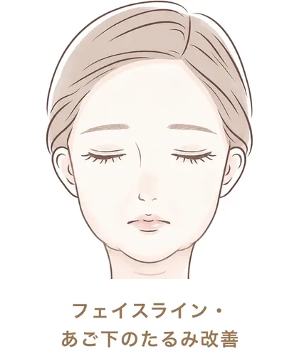 フェイスライン・あご下のたるみ改善