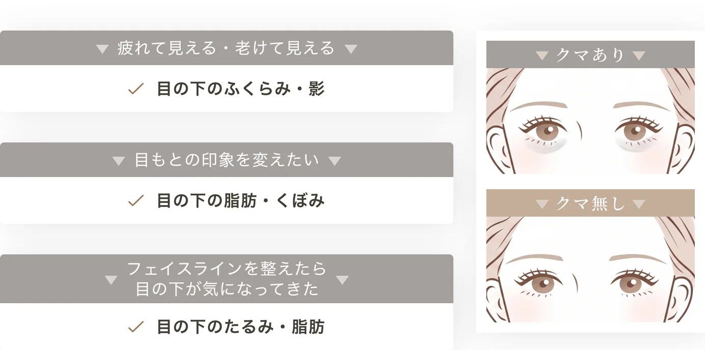 疲れて見える・老けて見える→目の下のふくらみ・影／目もとの印象を変えたい→目の下の脂肪・くぼみ／フェイスラインを整えたら目の下が気になってきた→目の下のたるみ・脂肪。クマありとクマ無しの目もとの比較イラスト