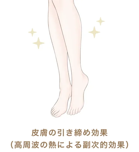 皮膚の引き締め効果（高周波の熱による副次的効果）