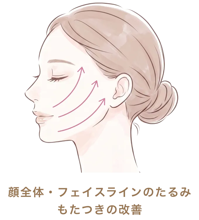 顔全体・フェイスラインのたるみもたつきの改善