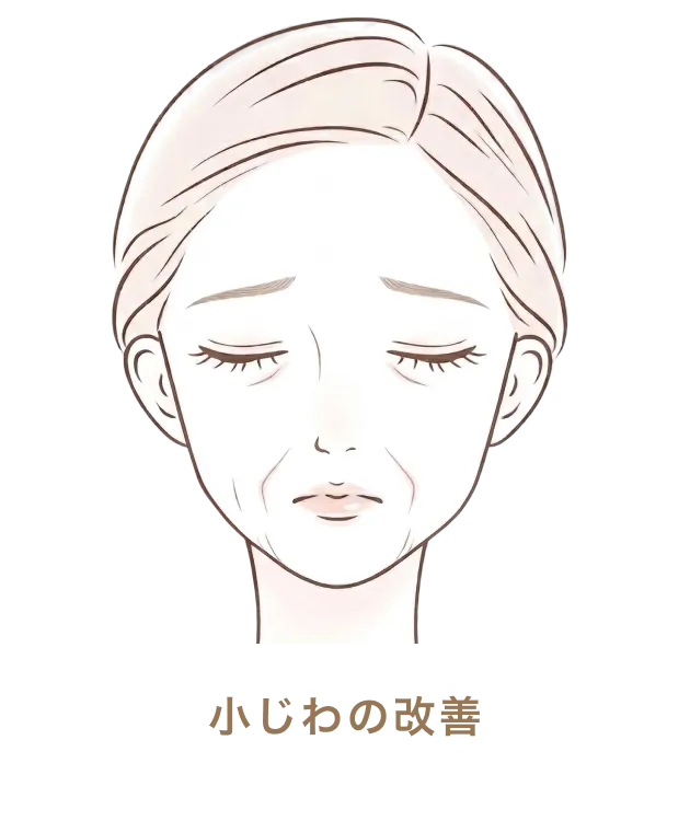 小じわの改善