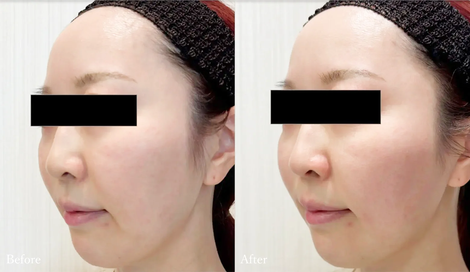 Before / After