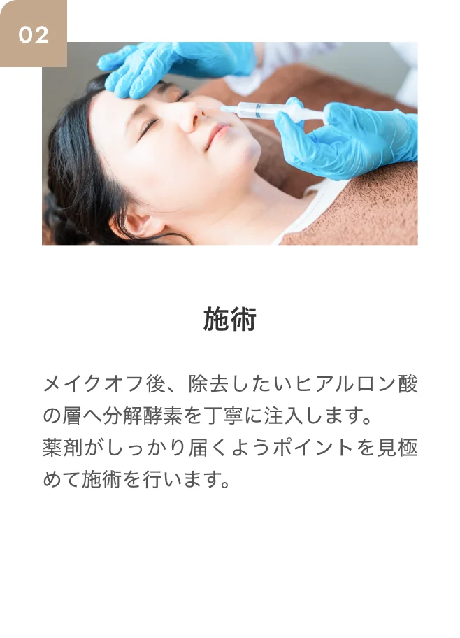 STEP02 施術 メイクオフ後、除去したいヒアルロン酸の層へ分解酵素を丁寧に注入します。薬剤がしっかり届くようポイントを見極めて施術を行います。
