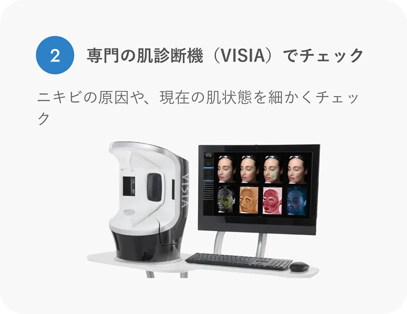 専門の肌診断機（VISIA）でチェック
